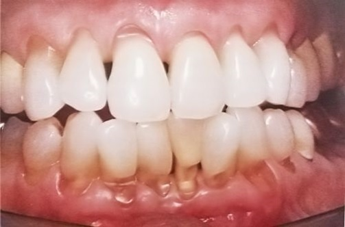 image-article