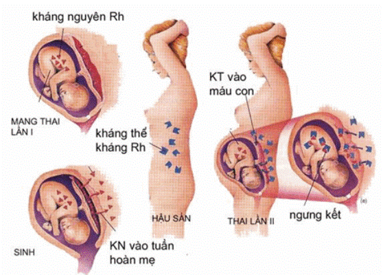 image-article