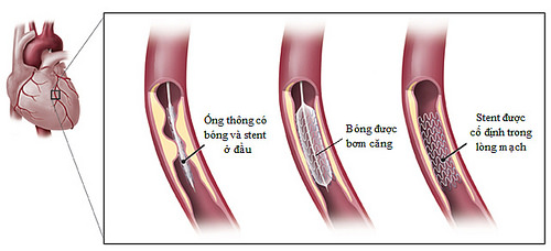 image-article