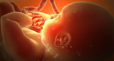 image-article