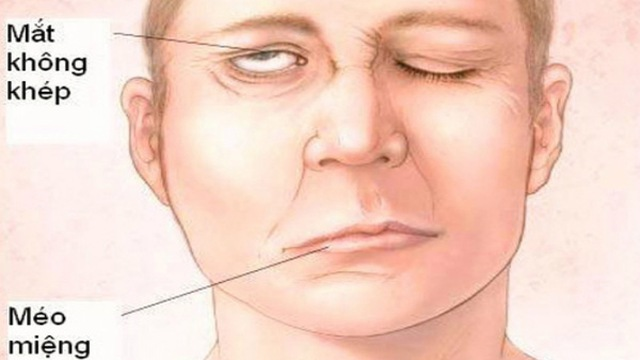 image-article