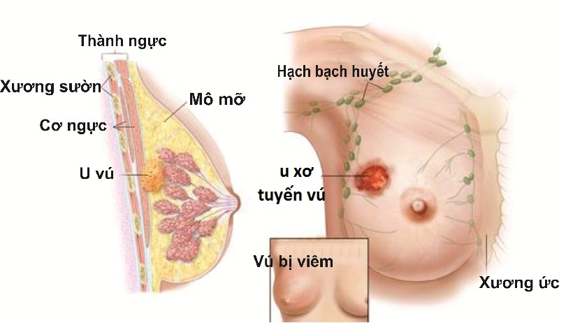 image-article