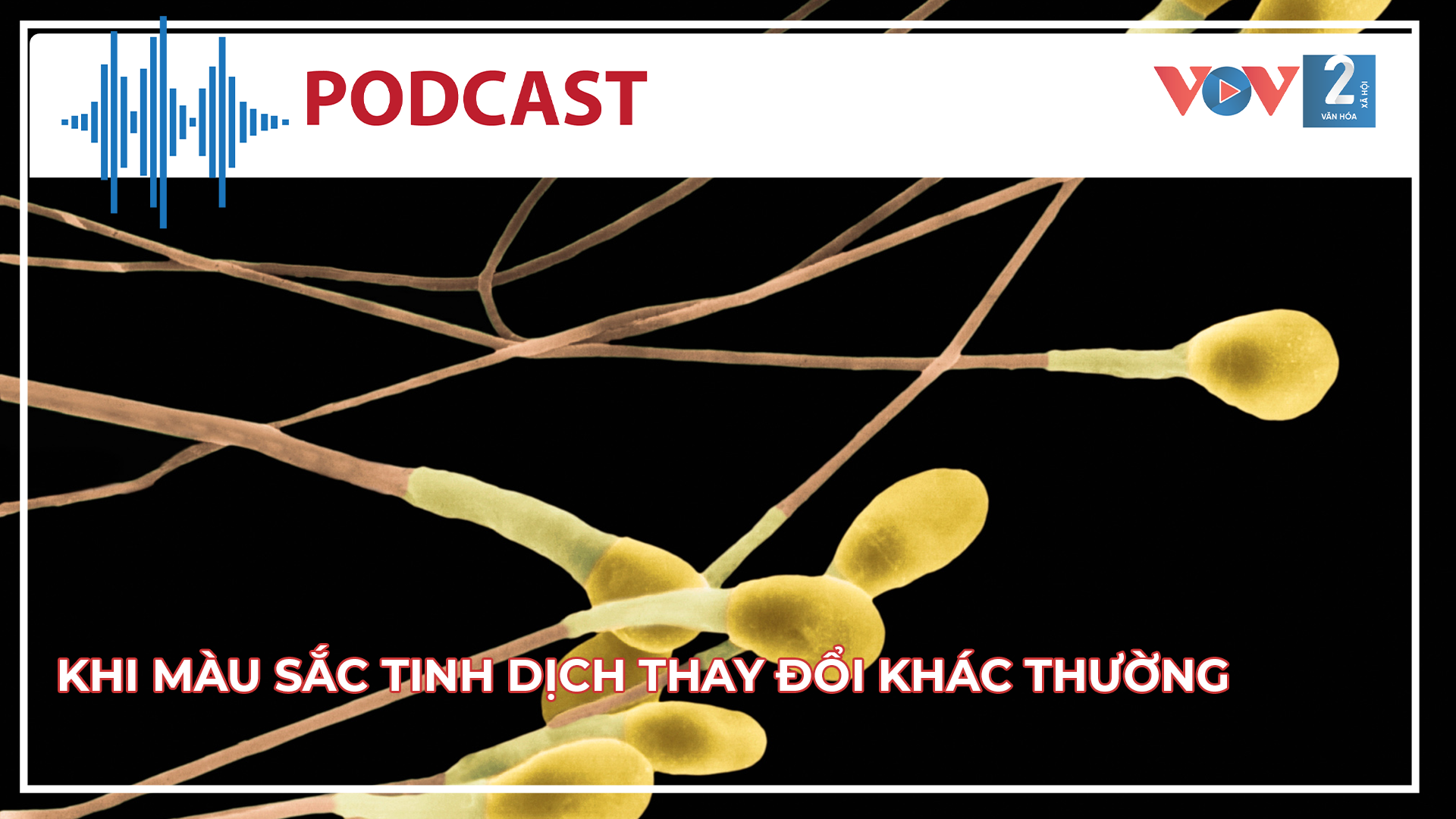Không chủ quan khi màu sắc tinh dịch thay đổi khác thường