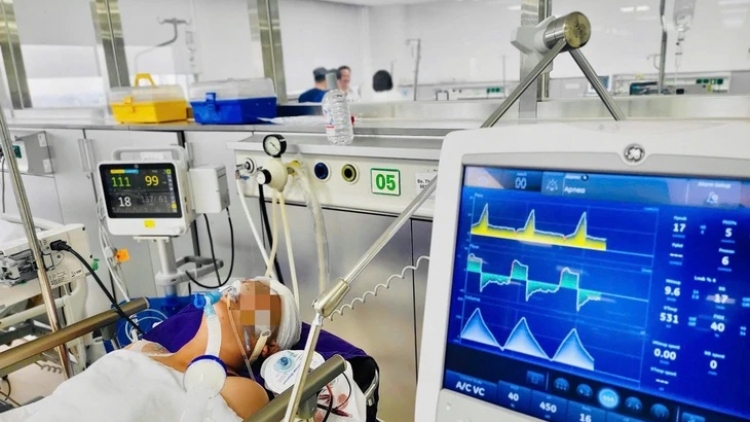 Đột quỵ ở Việt Nam trẻ hơn thế giới 10 tuổi