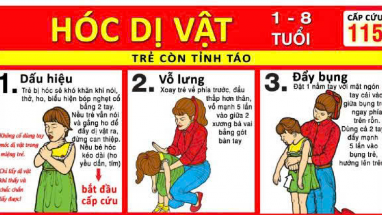 Hóc dị vật ở trẻ - Tai nạn nguy hiểm trong hè
