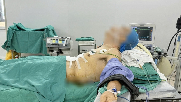 Phẫu thuật ung thư dạ dày cho bệnh nhân gù vẹo cột sống 