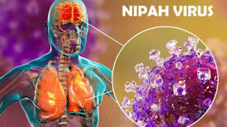 Tăng cường giám sát ca nghi nhiễm vi rút Nipah tại cửa khẩu