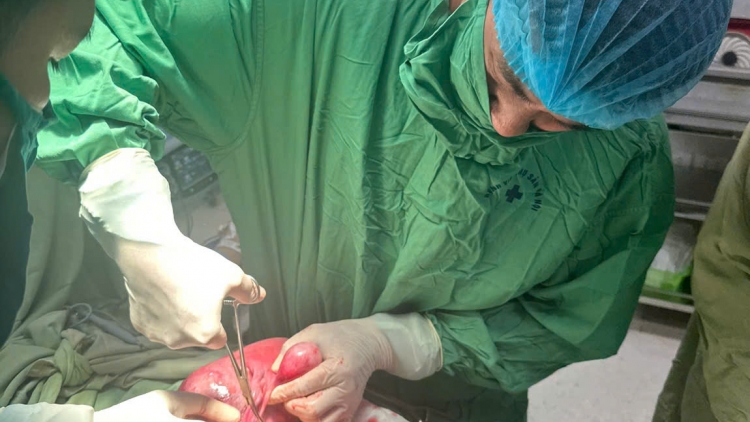 U xơ tử cung gây thiếu máu kéo dài