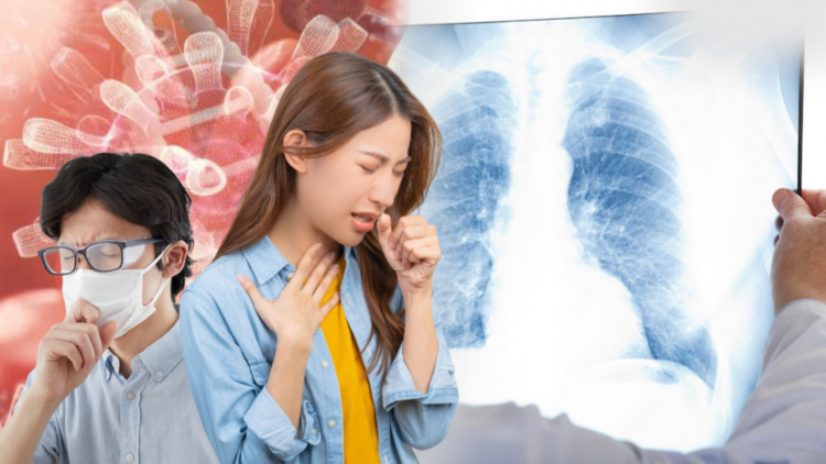 Bệnh lao gia tăng nhanh ở người trẻ