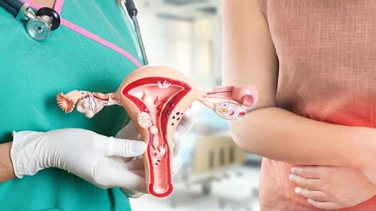 Khi nào nên đi tầm soát ung thư cổ tử cung?