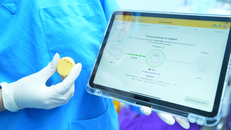 Kỹ thuật mới tăng độ chính xác, an toàn trong phẫu thuật cấy ốc tai điện tử