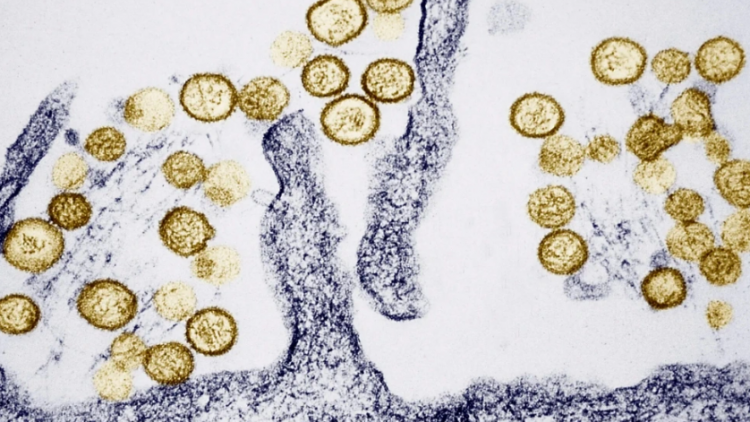 Ghi nhận ca tử vong do virus Hanta, Bộ Y tế khuyến cáo phòng bệnh