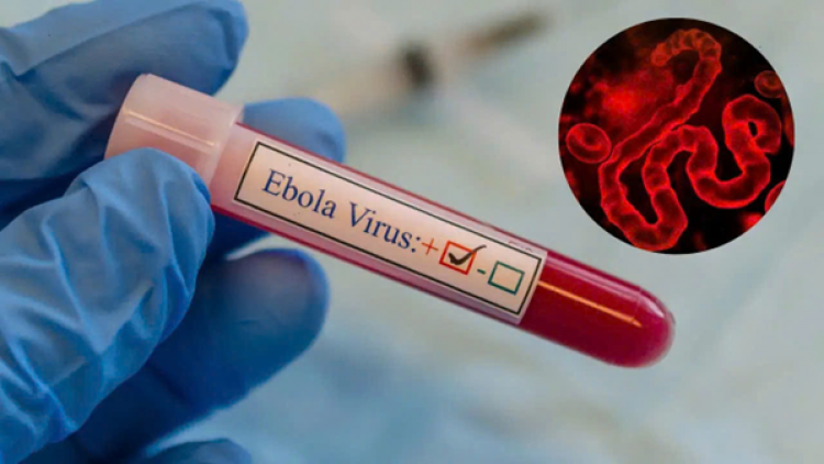 Mức độ rủi ro đối với chủng virus Ebola ở tại CHDC Congo ở mức rất cao