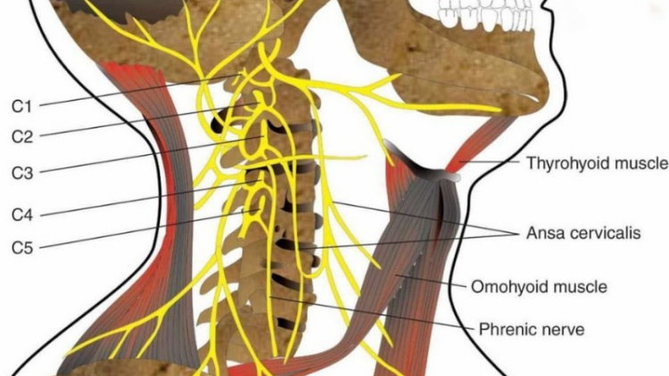 Nhận biết sớm viêm đa rễ thần kinh để điều trị hiệu quả