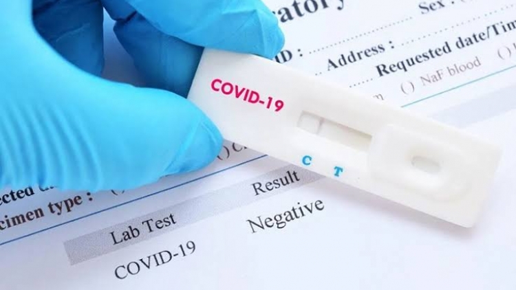 Số ca mắc Covid-19 có xu hướng tăng