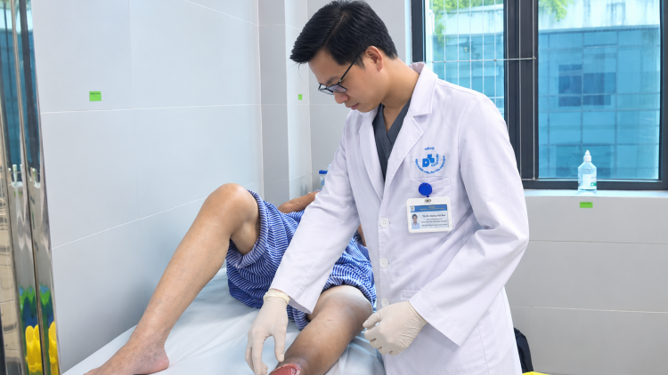 Tự đắp lá điều trị vết loét bệnh nhân bị hoại tử nặng nề vùng cẳng chân