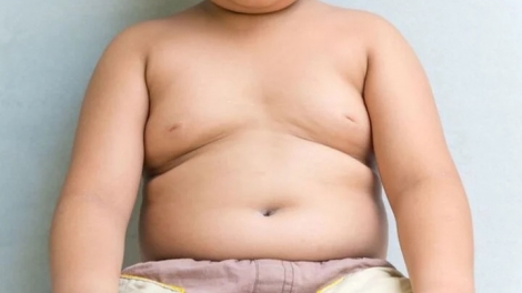 béo phì ở trẻ là do lối sống của gia đình