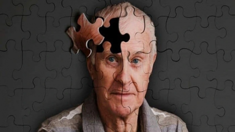 Khi cộng đồng cùng quan tâm tới người cao tuổi mắc Alzheimer