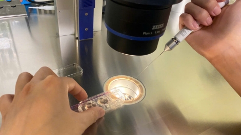 Trữ đông trứng không phải là “tấm vé an toàn” cho việc kết hôn muộn