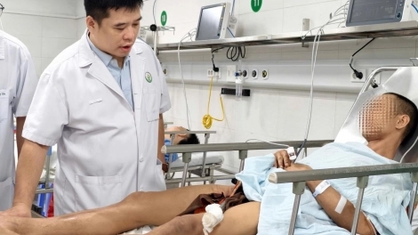 Lấy thành công thanh xà beng dài 1,5m xuyên qua đùi bệnh nhân