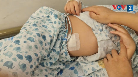 Thoát vị bẹn ở trẻ: Cần cảnh giác với những dấu hiệu nguy hiểm khó lường