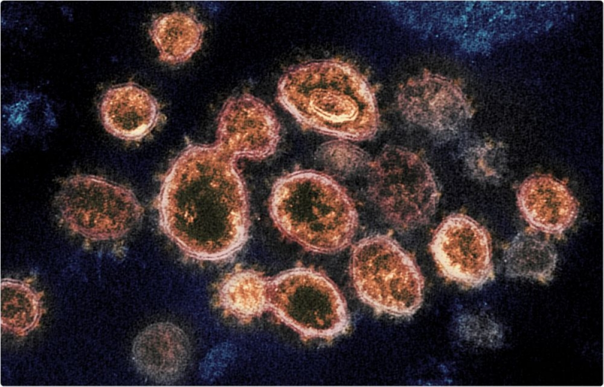 Virus corona biến chủng sẽ  làm gia tăng mức độ nghiêm trọng của dịch Covid-19 (Ảnh minh họa)