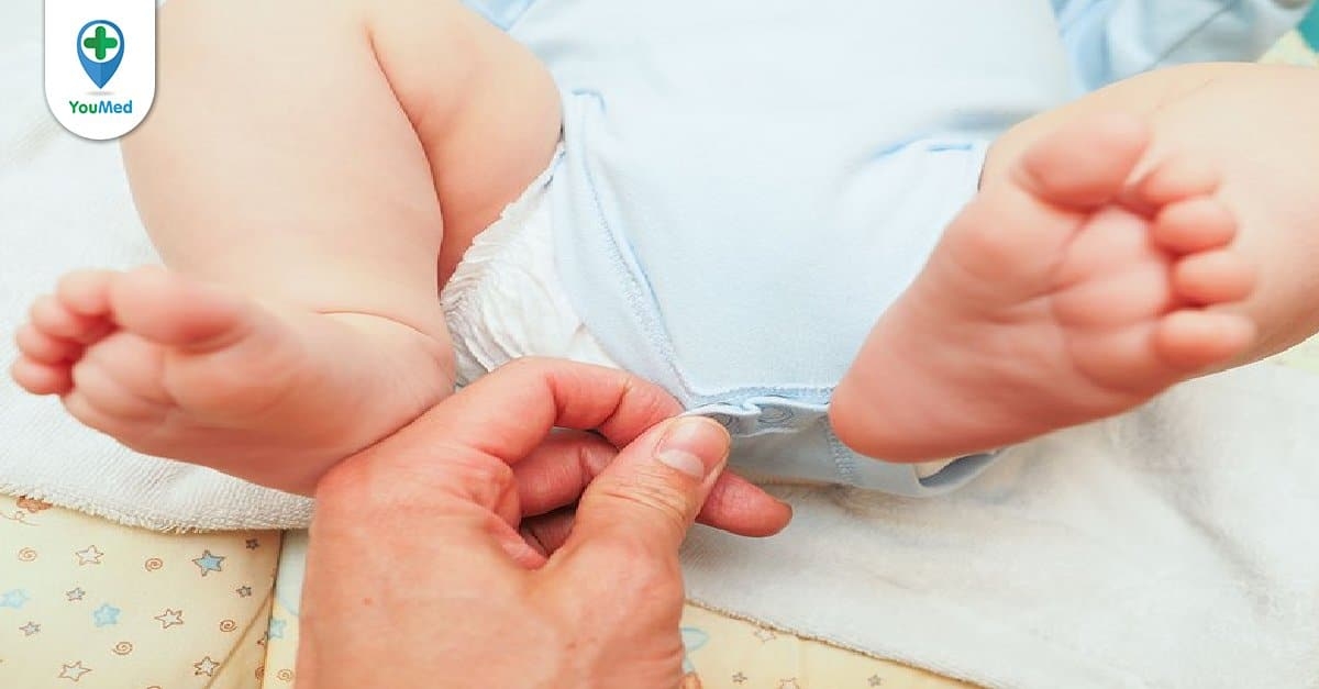 Đóng bỉm cho con mà không thường xuyên thay là nguyên nhân dẫn đến hẹp bao quy đầu bệnh lý ở trẻ