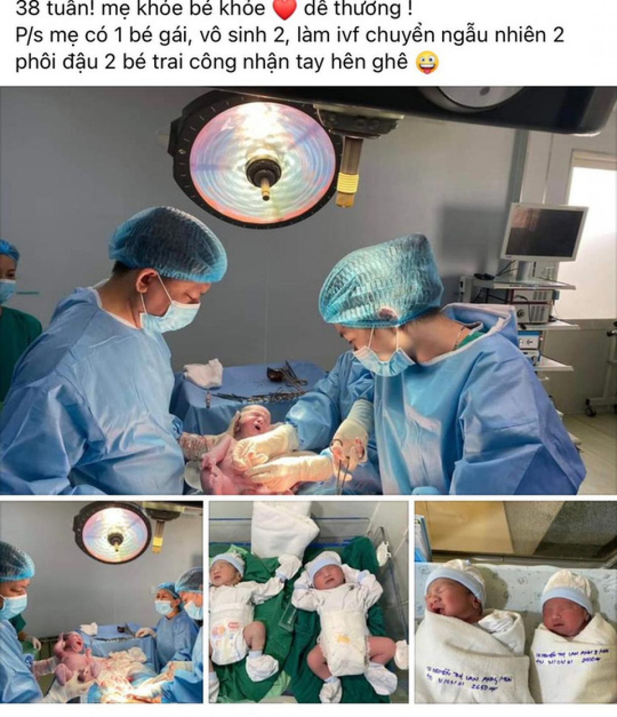 Hình ảnh 2 em bé song sinh được đính kèm câu chuyện của BS Khoa là ảnh cũ 