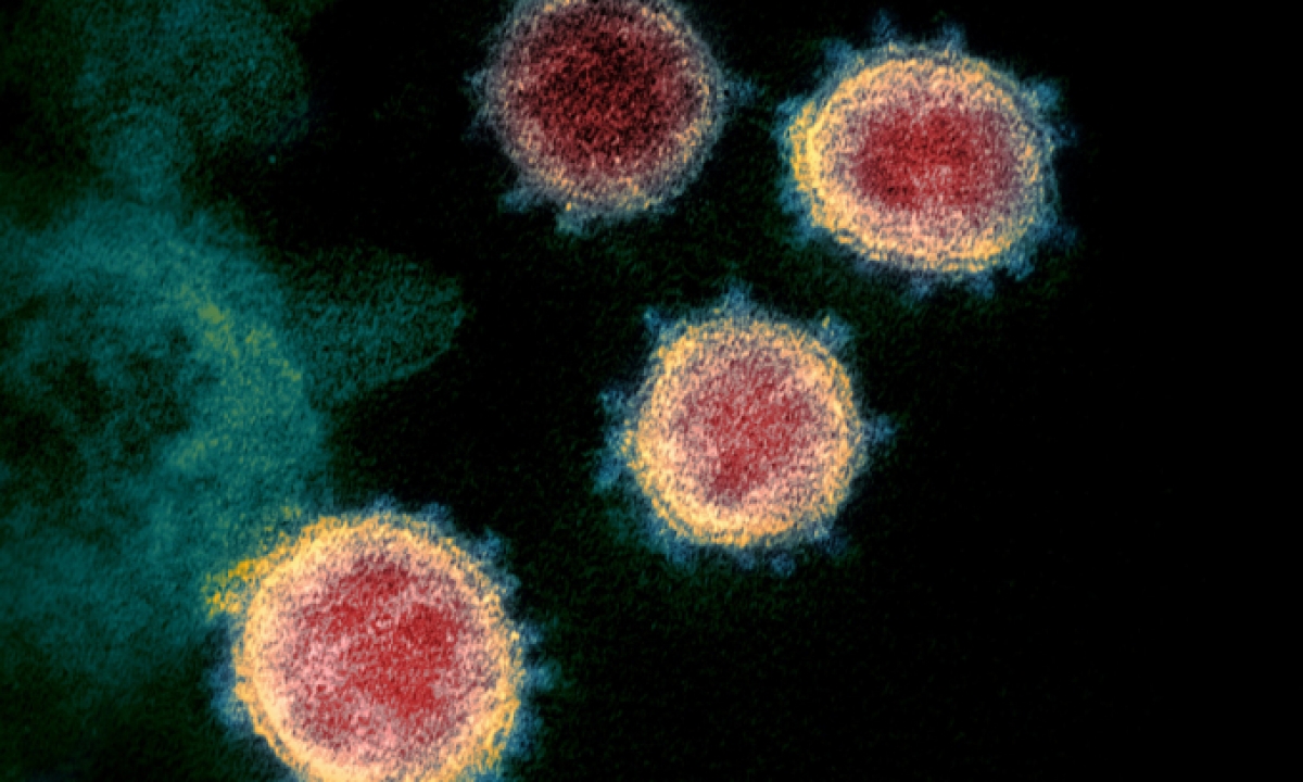 Hình ảnh virus nCoV được phân lập ở một bệnh nhân Covid-19 ở Mỹ.