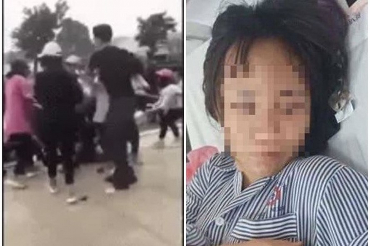 Một nữ sinh ở Quảng Ninh bị đánh hội đồng.