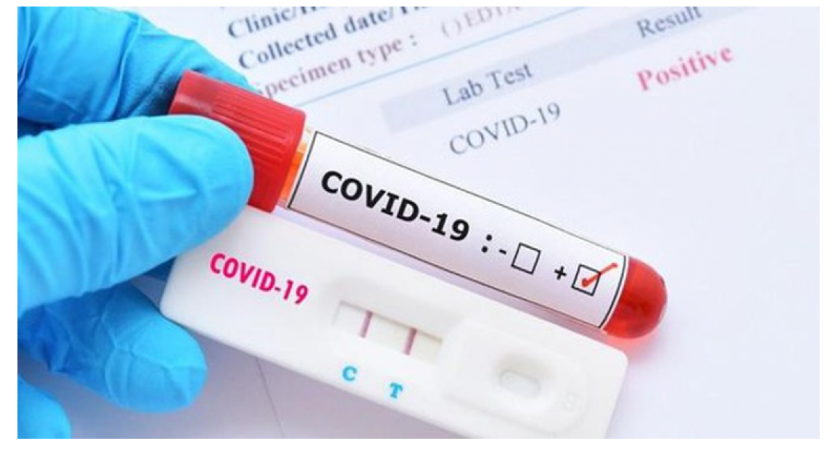 Cơ sở y tế không được thu thêm của người bệnh hoặc yêu cầu người bệnh tự chi trả các chi phí liên quan đến việc thực hiện xét nghiệm COVID-19