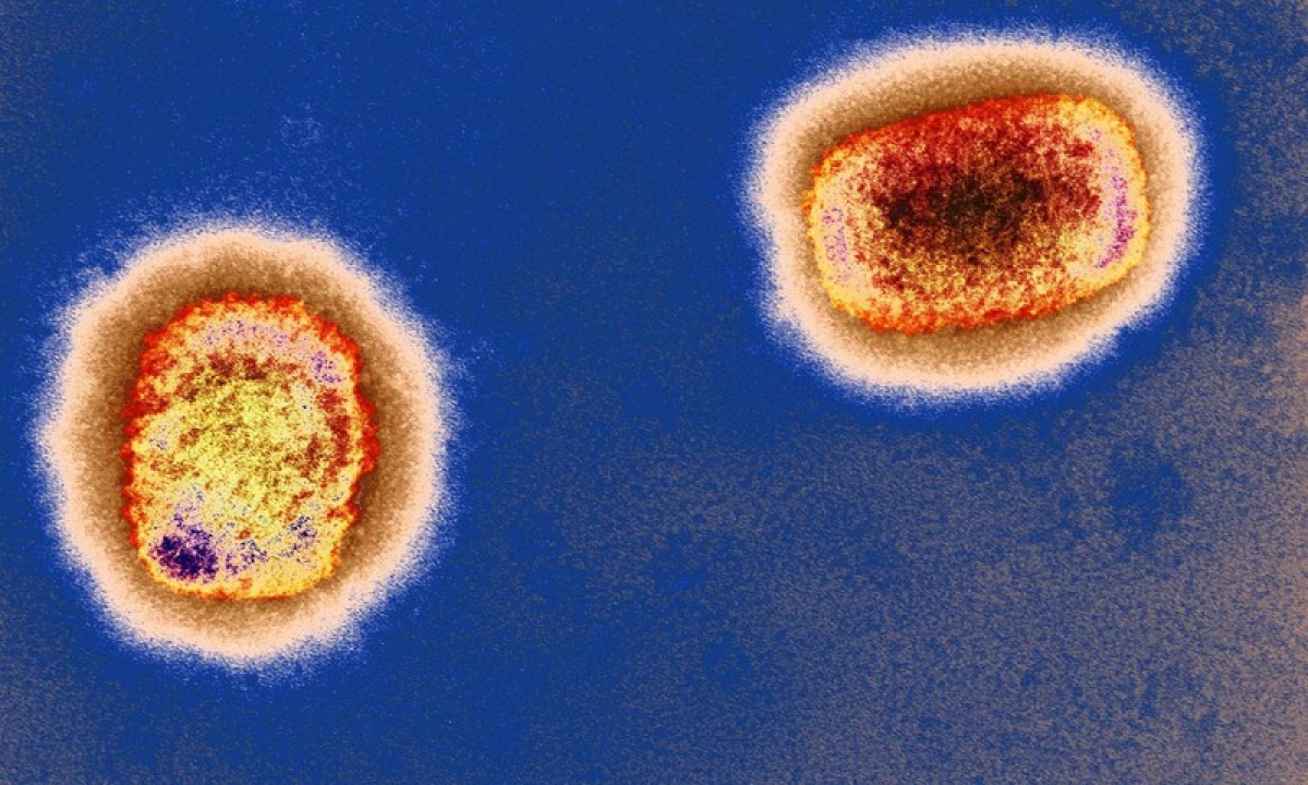 Virus gây bệnh đậu mùa ở khỉ dưới kính hiển vi