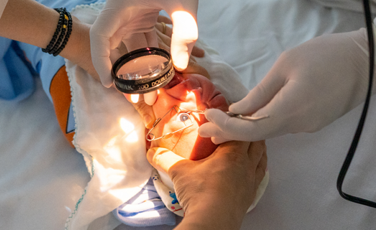 Khi đến khám sàng lọc, bác sĩ phải tra giãn đồng tử và soi đáy mắt bằng một cái đèn chuyên dụng để chẩn đoán bệnh võng mạc cho trẻ