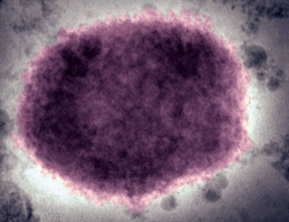Hình ảnh virus gây bệnh đậu mùa khỉ