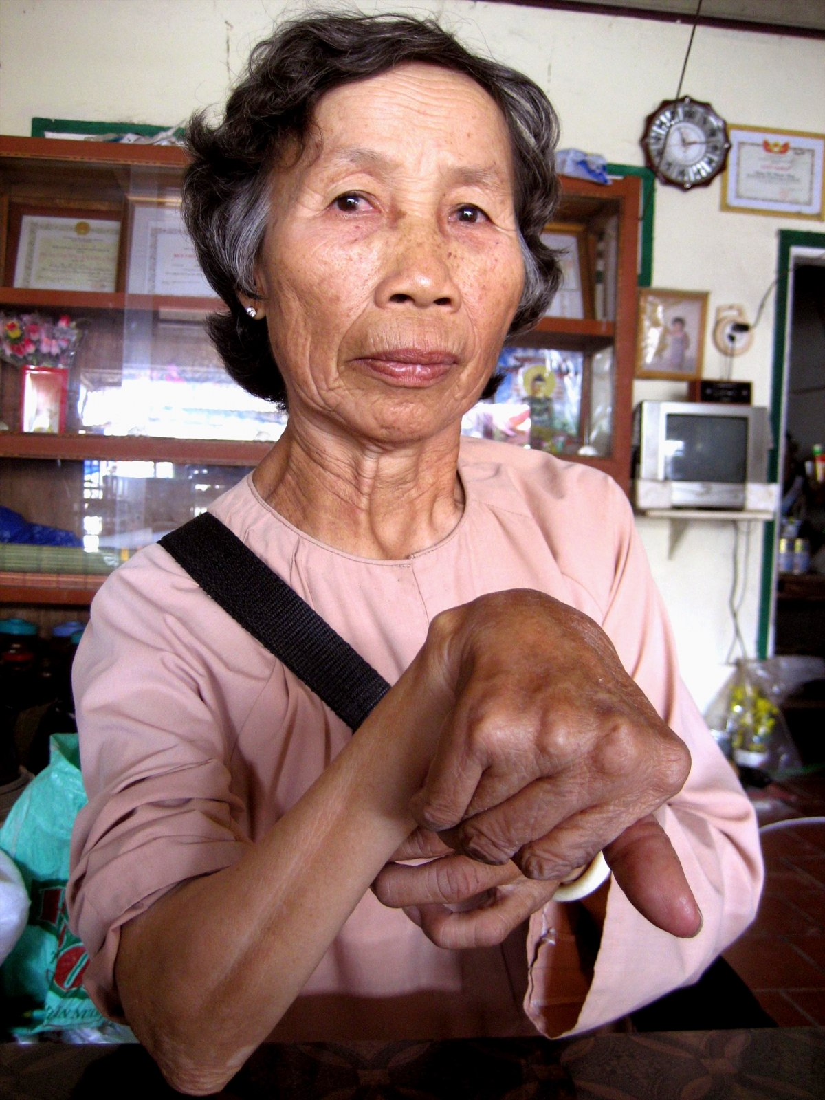 Bà Đặng Thị Bảy trong cuộc sống đời thường với thương tật ở bàn tay