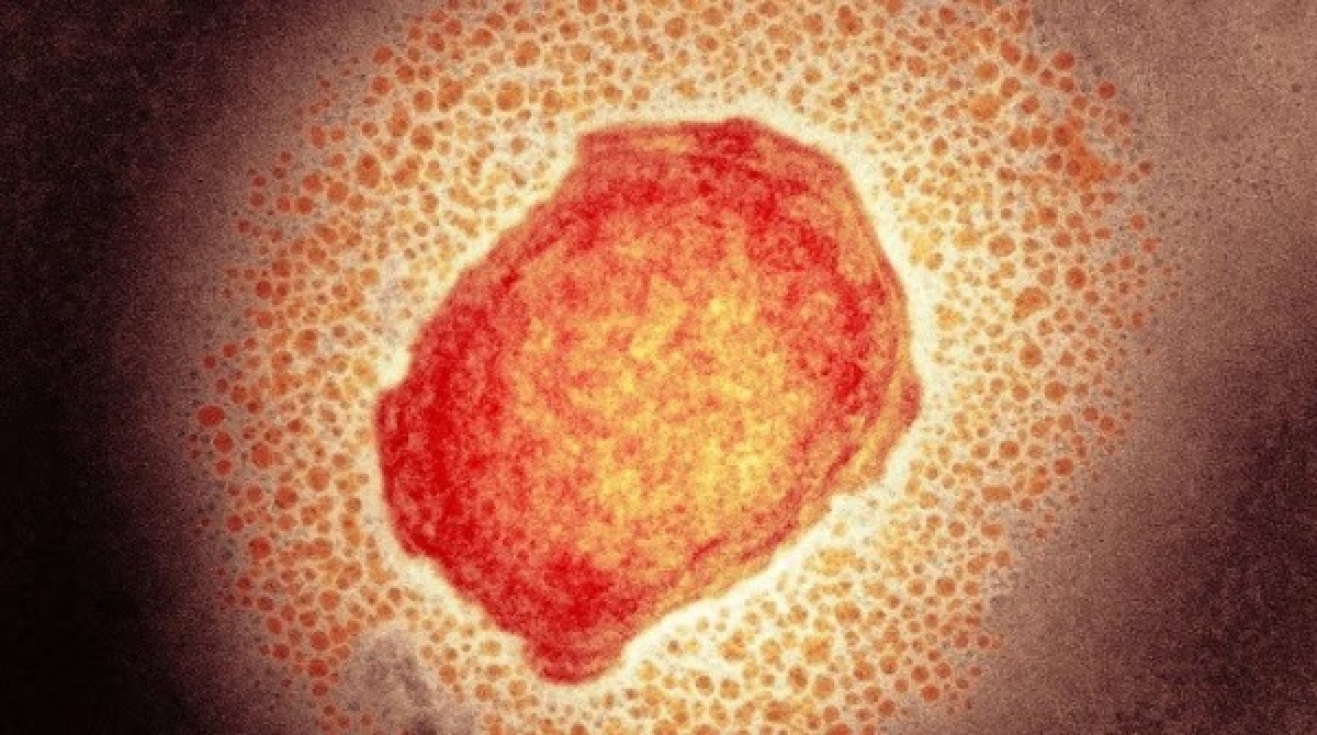 Virus đậu mùa khỉ có nguy cơ bùng phát mạnh vào mùa hè
