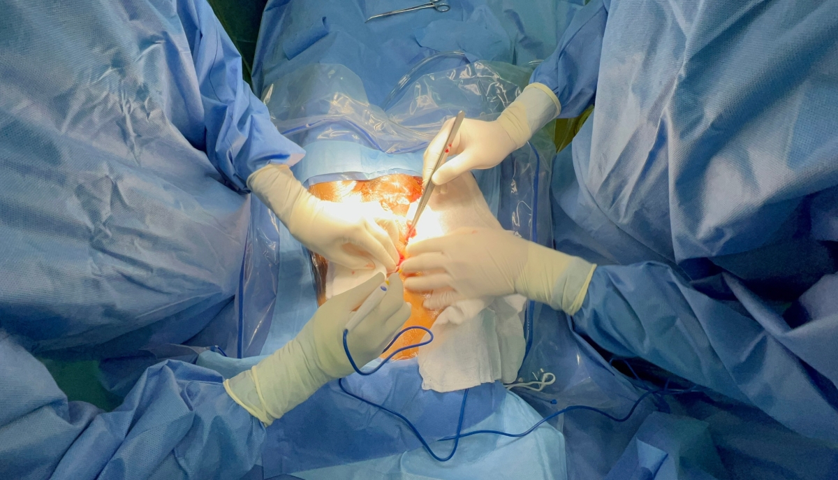 Ca phẫu thuật cắt bỏ khối u và tử cung cho bệnh nhân (Ảnh: BVCC)