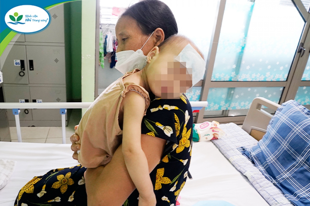 Em gái bệnh nhi V.L, bé M.H (18 tháng tuổi) đang được điều trị ngộ độc vitamin D tại bệnh viện