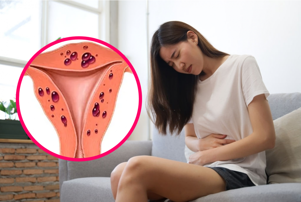 Nếu thường xuyên bị đau bụng trong mỗi kỳ kinh nguyệt, chị em nên đến các cơ sở y tế chuyên về sản khoa để được phát hiện sớm tình trạng lạc nội mạc tử cung