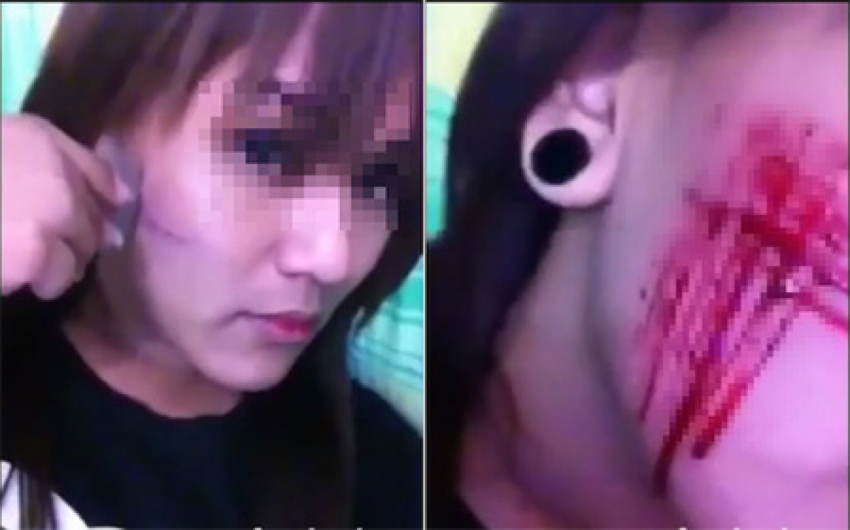 Hình ảnh cô gái tự cầm dao rạch mặt gây sốt mạng xã hội thời gian qua (Ảnh: KT)
