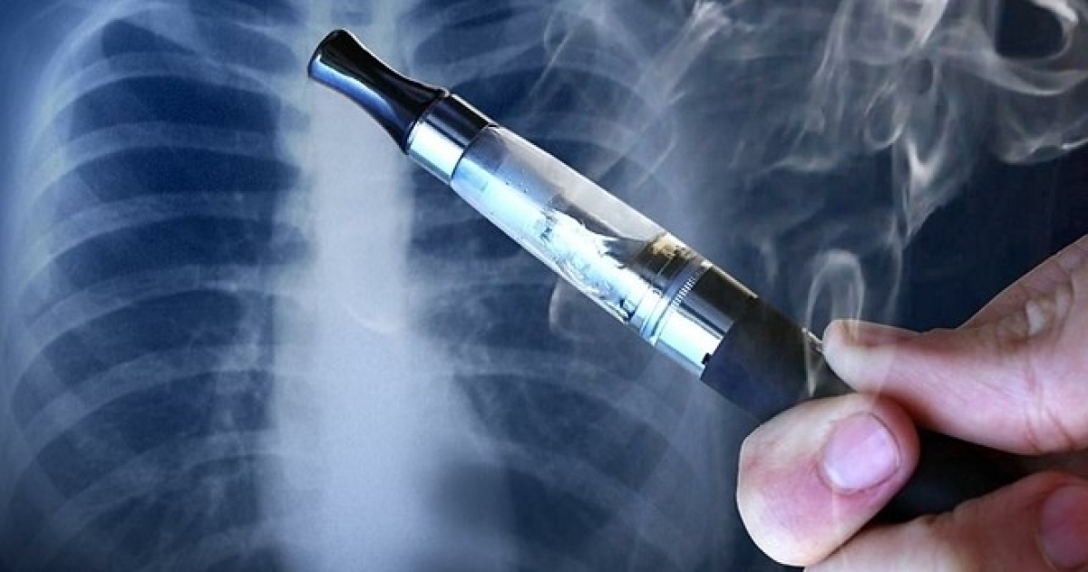 Việc sử dụng thuốc lá điện tử có thể gây tổn thương phổi không hồi phục.