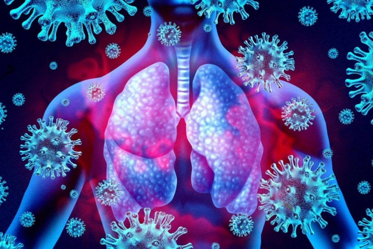 Viêm phổi là bệnh lý rất thường gặp ở người cao tuổi trong mùa lạnh