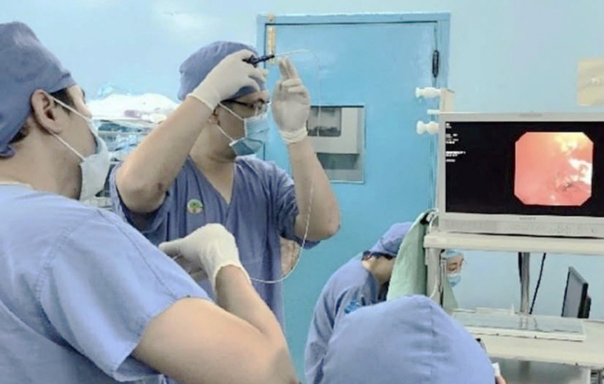 Các bác sĩ Bệnh viện Nhi đồng 2 đang nội soi cho một cháu bé bị dị vật đường thở - Ảnh: T.Phương