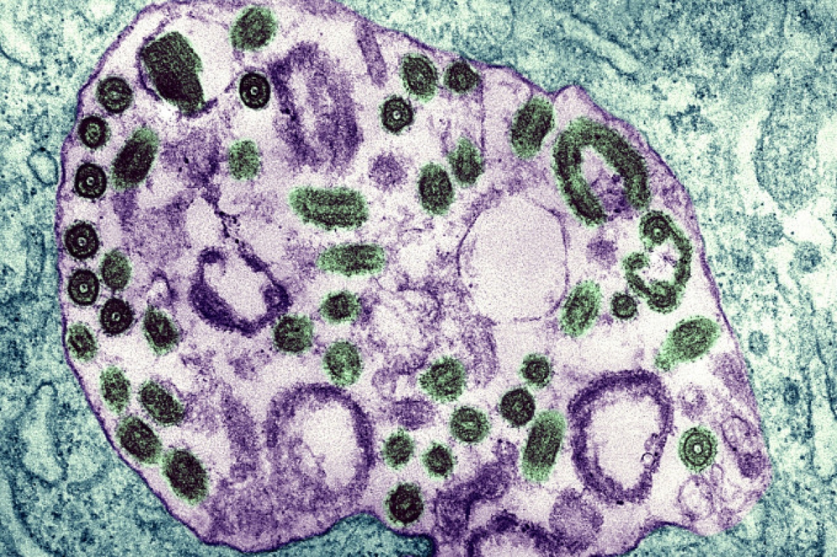 Hình ảnh virus Marburg dưới kính hiển vi. Ảnh: BSIP