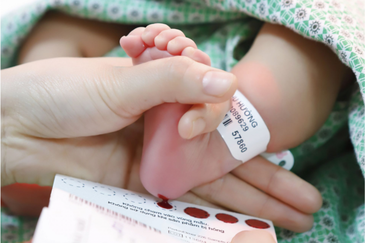 Lấy mẫu máu gót chân trẻ sơ sinh để sàng lọc phát hiện dị tật bẩm sinh tại Bệnh viện Phụ sản Hà Nội.