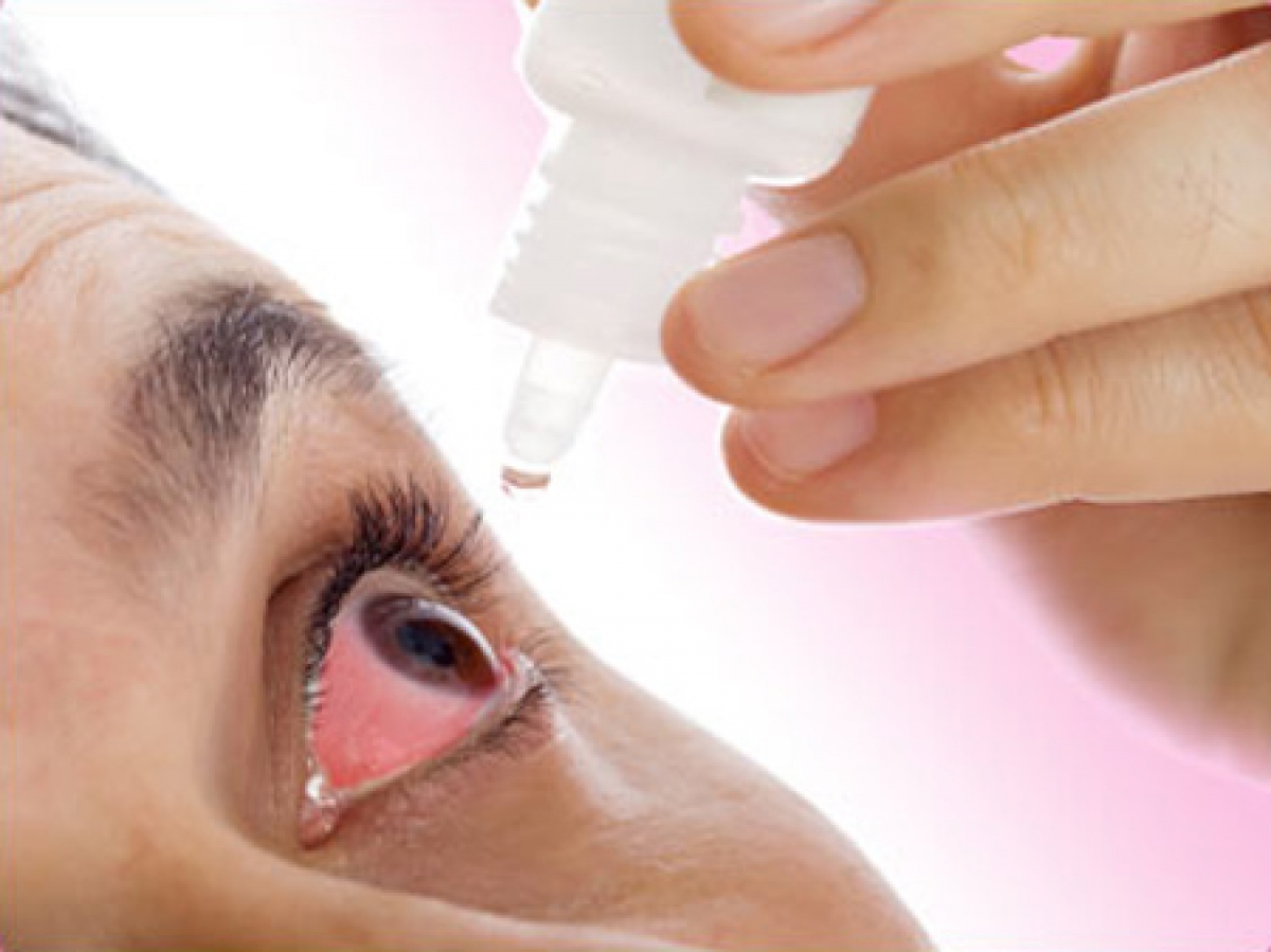 Lạm dụng thuốc nhỏ mắt chứa corticoid kéo dài có thể gây nhiều biến chứng nguy hiểm.