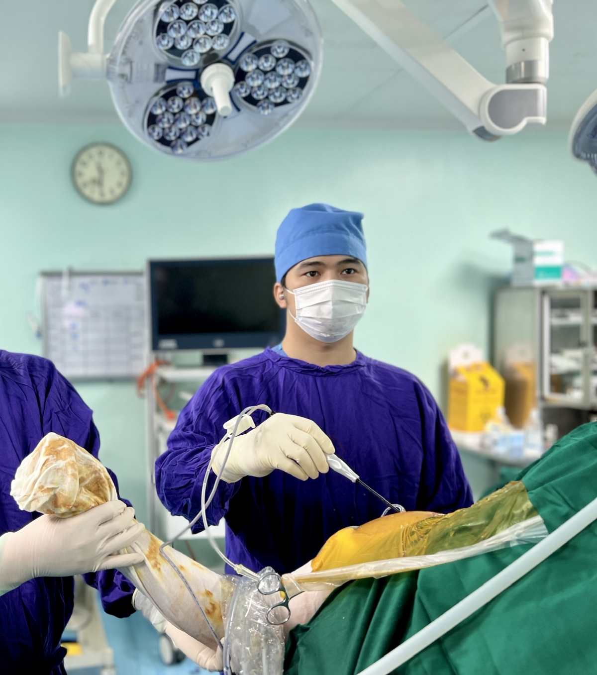 BS Nguyễn Mạnh Linh thực hiện phẫu thuật nội soi gắp toàn bộ u sụn và cắt vùng màng hoạt dịch bị viêm cho bệnh nhân