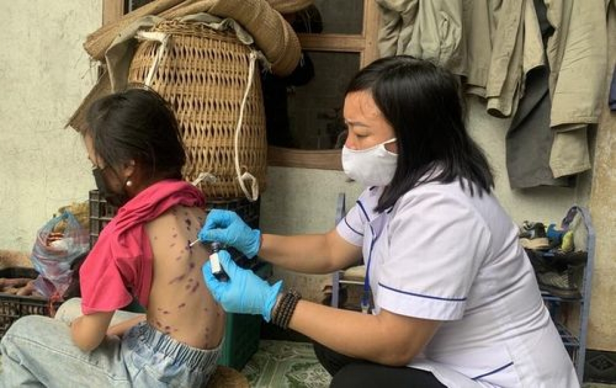 Nhân viên y tế xuống các hộ gia đình để thăm khám, chữa trị bệnh thủy đậu cho học sinh