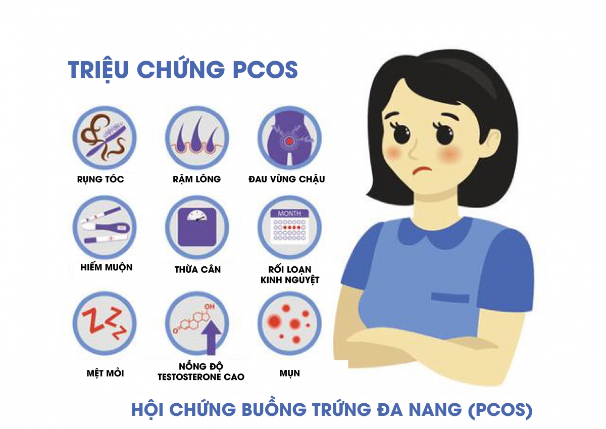 Biểu hiện khi bị buồng trứng đa nang