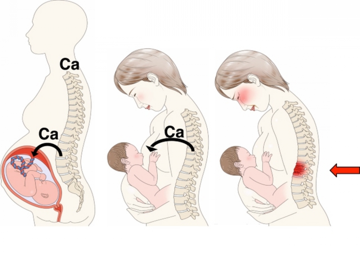 Mẹ phải chia sẻ canxi cho con trong quá trình mang thai và cho con bú